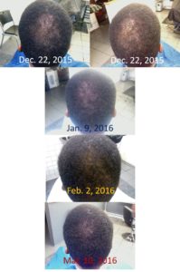 curtis_regrowth_from_monat